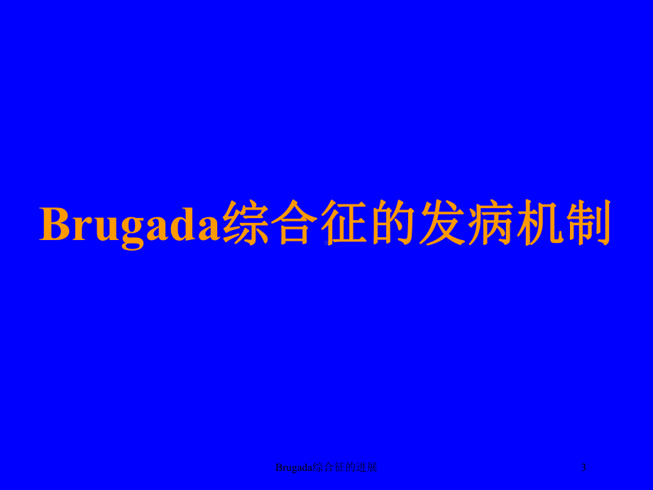 Brugada综合征的进展培训课件.ppt_第3页