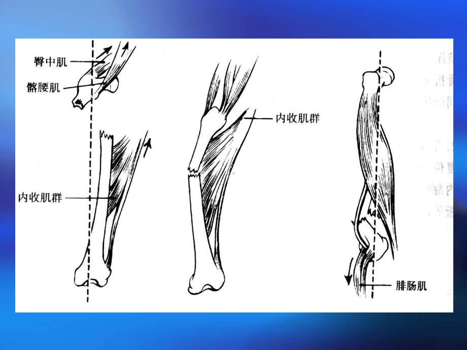 下肢脊柱骨折课件.pptx_第2页