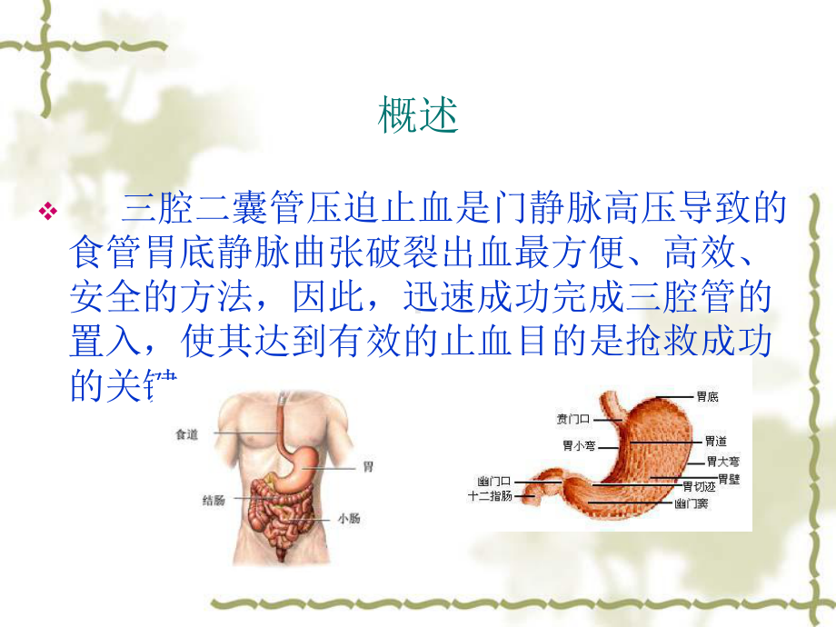 三腔二囊管的应用和护理87245课件.ppt_第2页