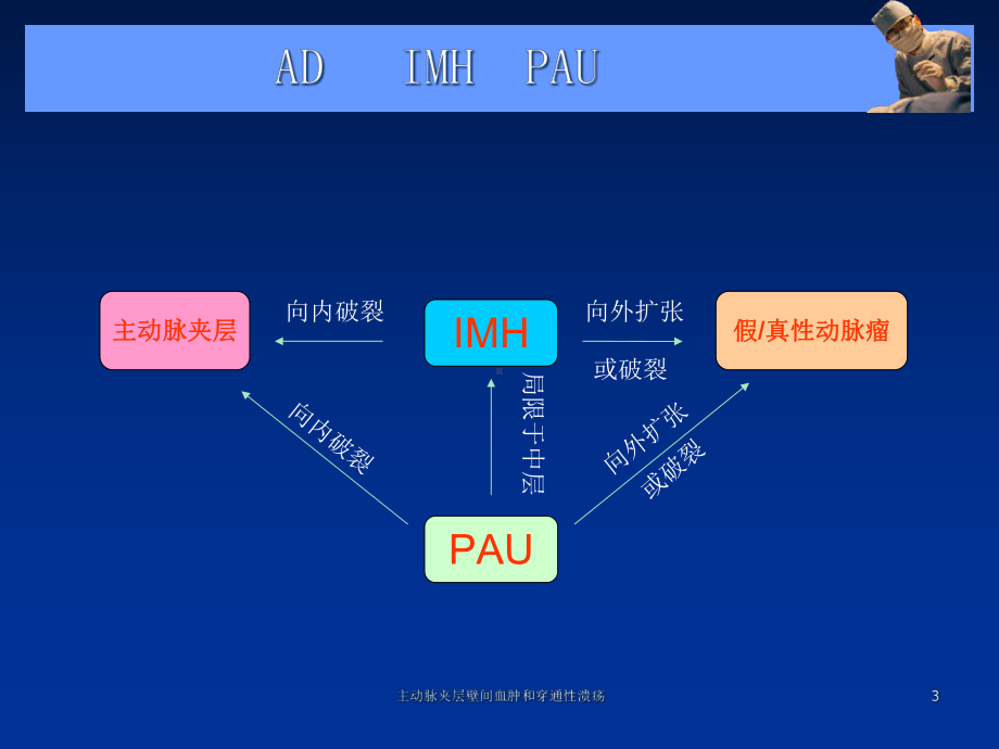 主动脉夹层壁间血肿和穿通性溃疡培训课件.ppt_第3页