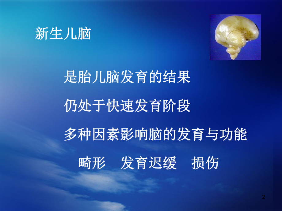 aEEG对新生儿脑功能监测意义医学课件.ppt_第2页