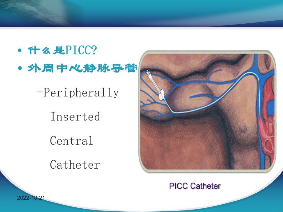 PICC维护过程中常见的并发症课件.ppt_第2页