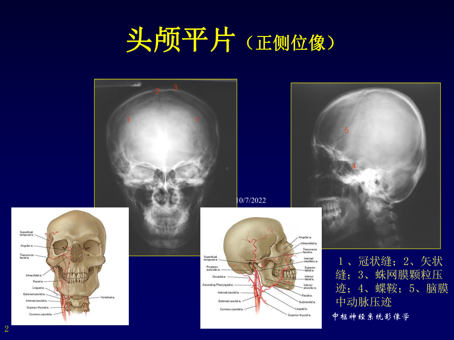 中枢神经系统影像学培训课件.ppt_第2页