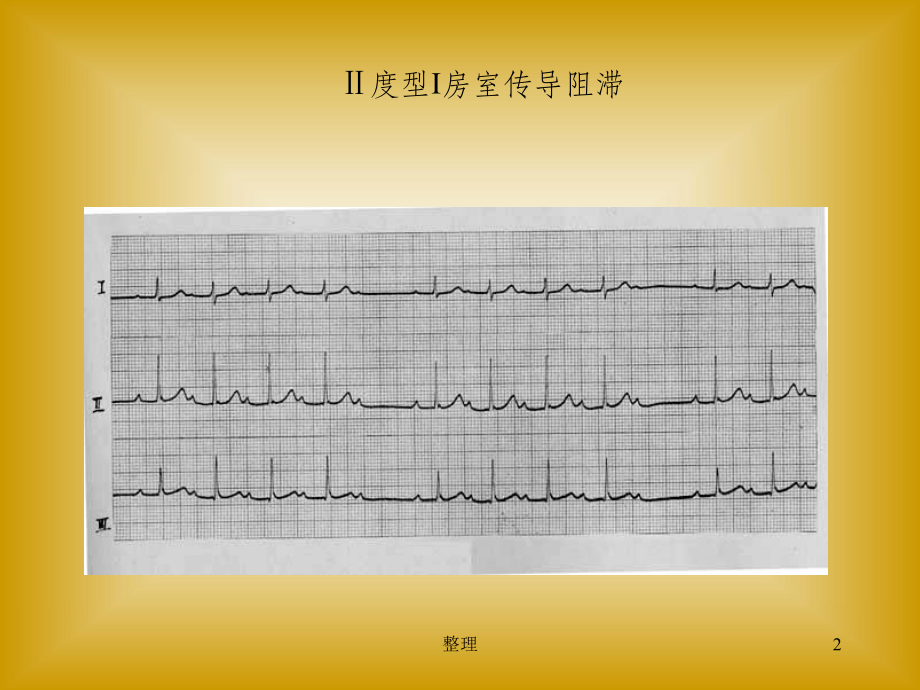 临床执业医师技能考试心电图及影像考试题答案精选课件.ppt_第2页