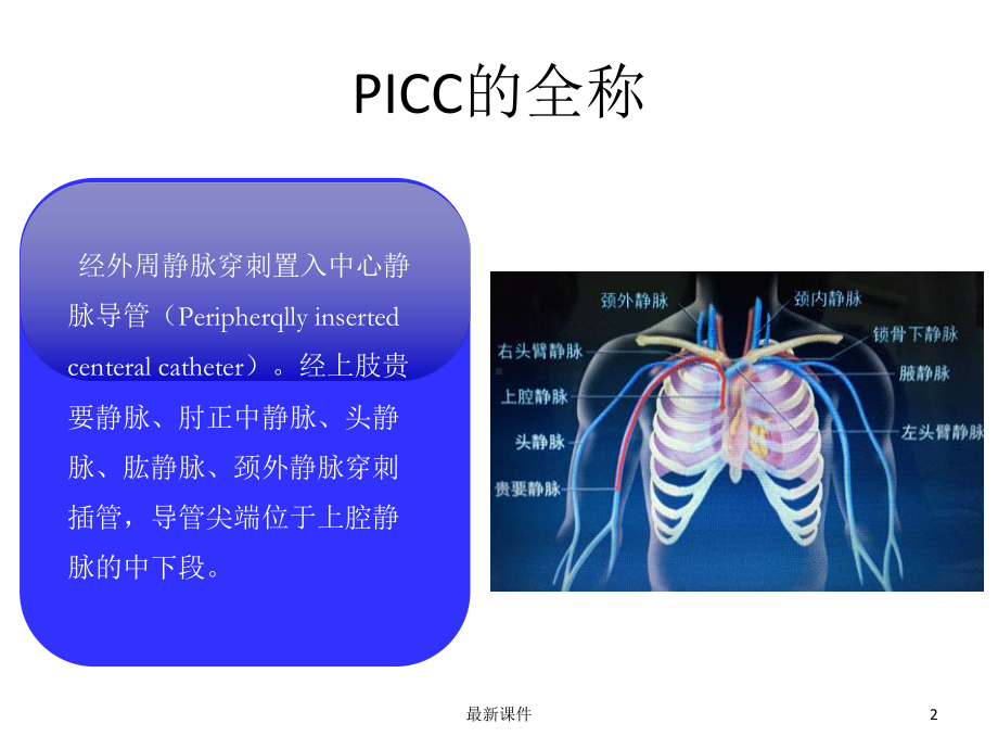 picc置管护理精课件.ppt_第2页