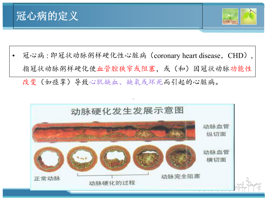 一例冠心病伴不稳定型心绞痛患者的病例分析课件.ppt_第3页