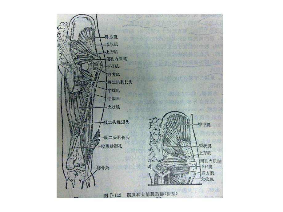 骨盆肌肉MRI解剖课件.ppt_第2页