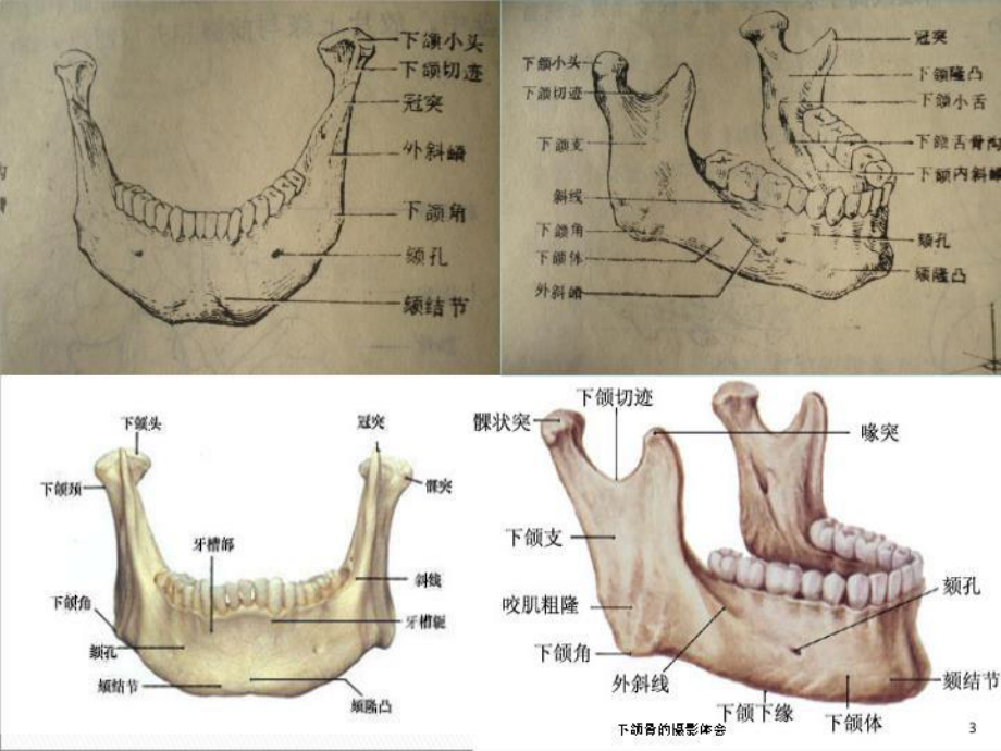 下颌骨的摄影体会培训课件.ppt_第3页