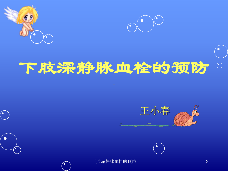 下肢深静脉血栓的预防课件.ppt_第2页