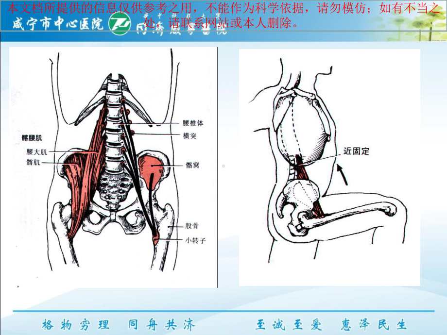 下交叉综合征培训课件.ppt_第2页