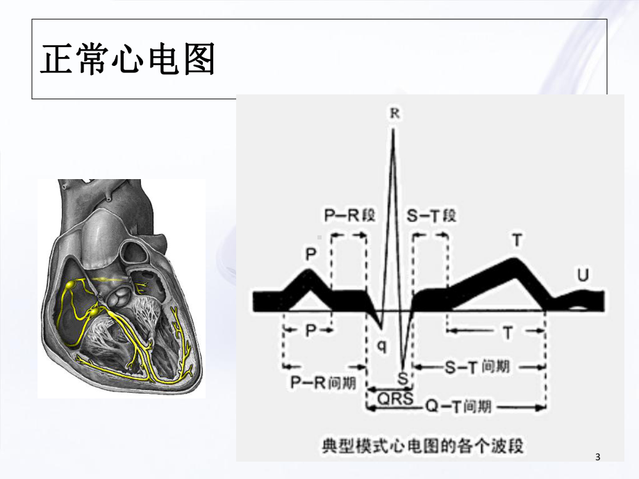 严重心律失常的急救与护理学习课件.ppt_第3页