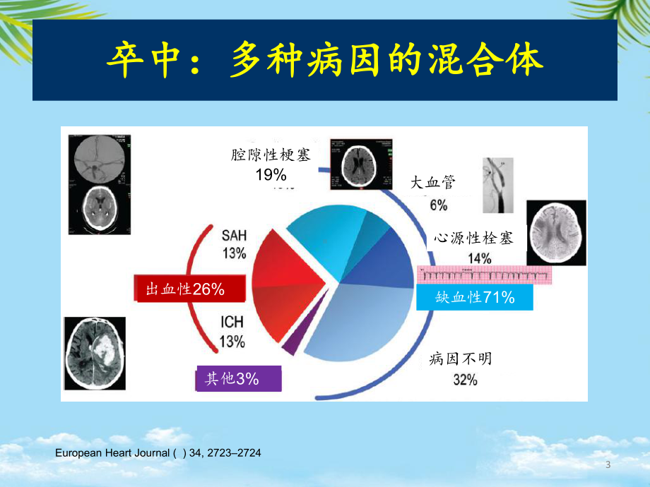 TIA的诊断和治疗课件.ppt_第3页