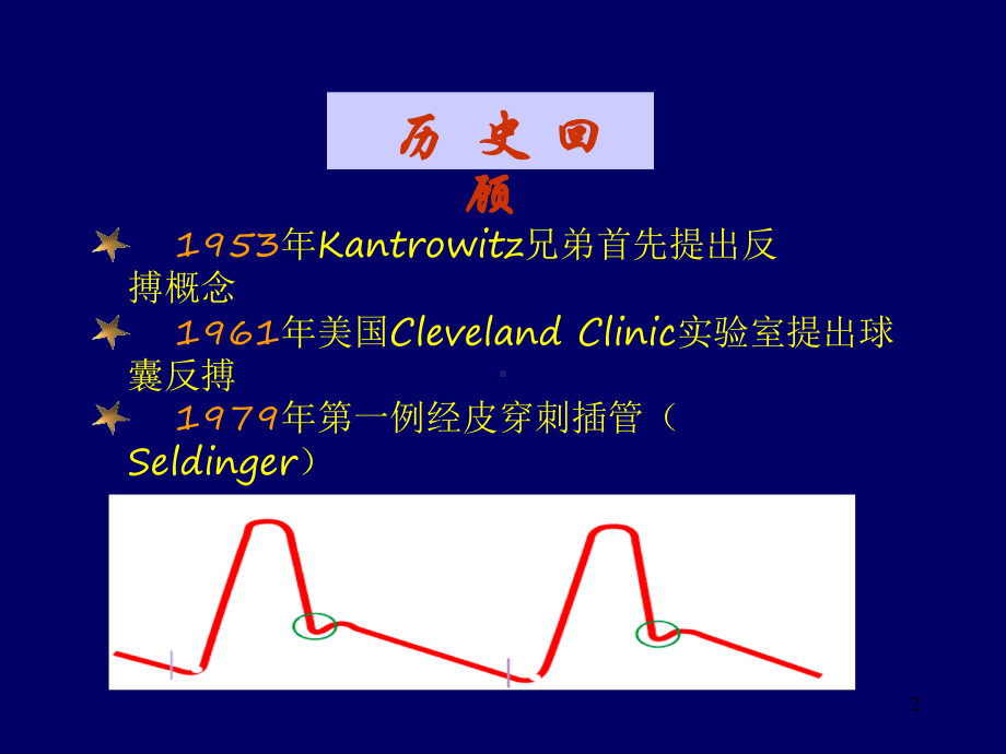 主动脉内球囊反搏泵演示文稿课件.ppt_第2页