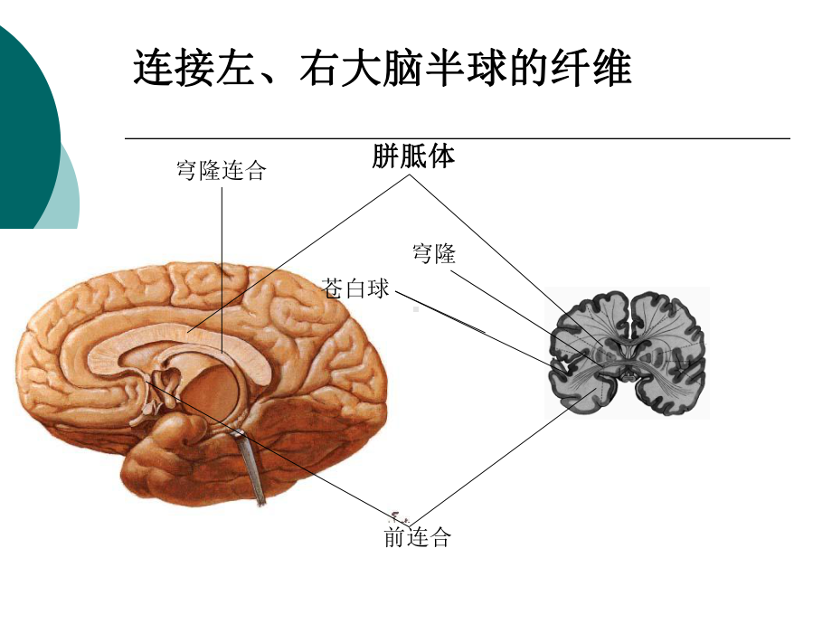 中枢神经系统课件.pptx_第3页