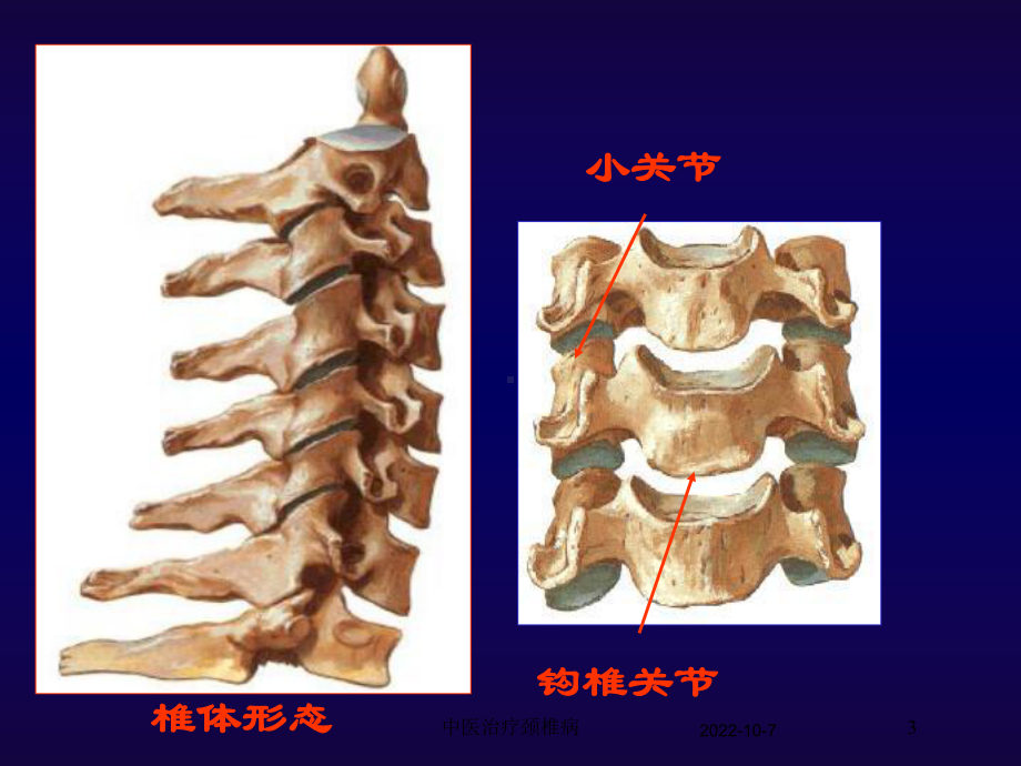 中医治疗颈椎病培训课件.ppt_第3页