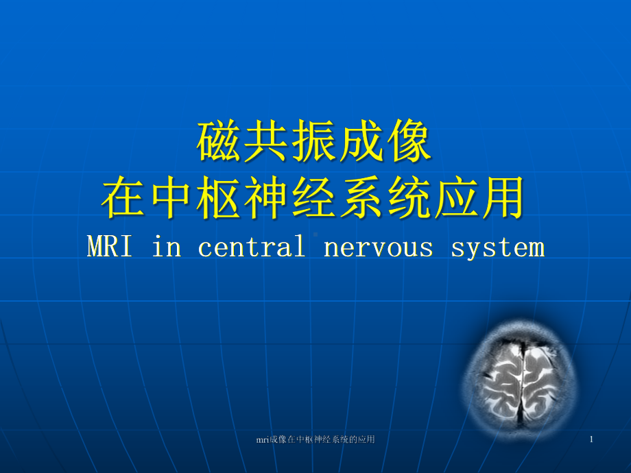 mri成像在中枢神经系统的应用课件.ppt_第1页