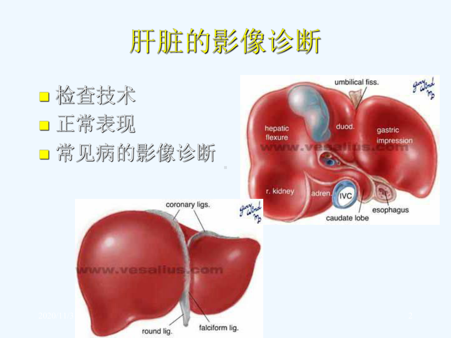 上腹部CT和MRI诊断详解课件.ppt_第2页