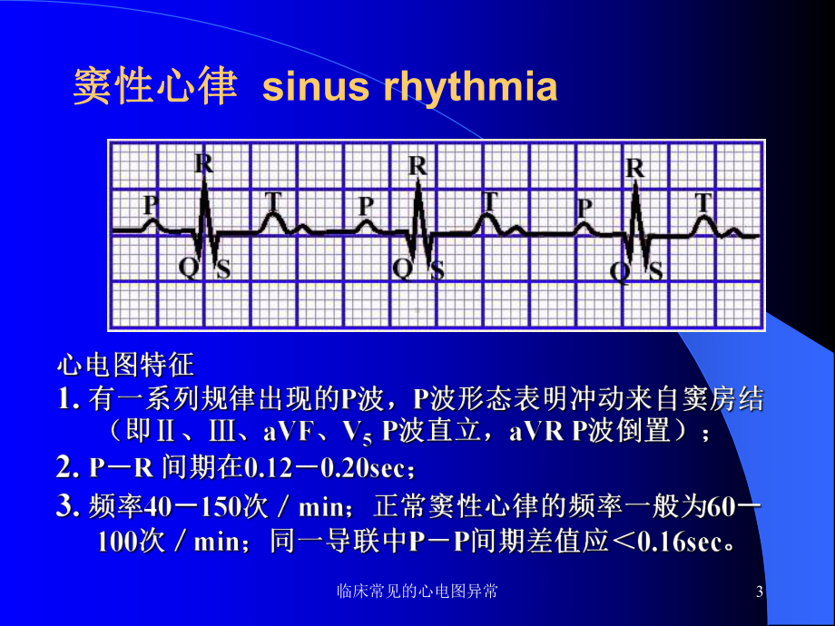 临床常见的心电图异常课件.pptx_第3页