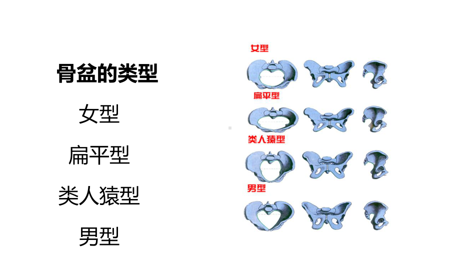 第九版妇产科学产道异常章节课件.ppt_第3页