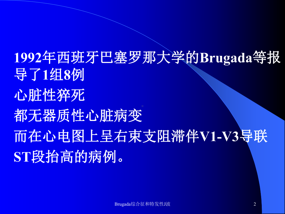 Brugada综合征和特发性J波培训课件.ppt_第2页