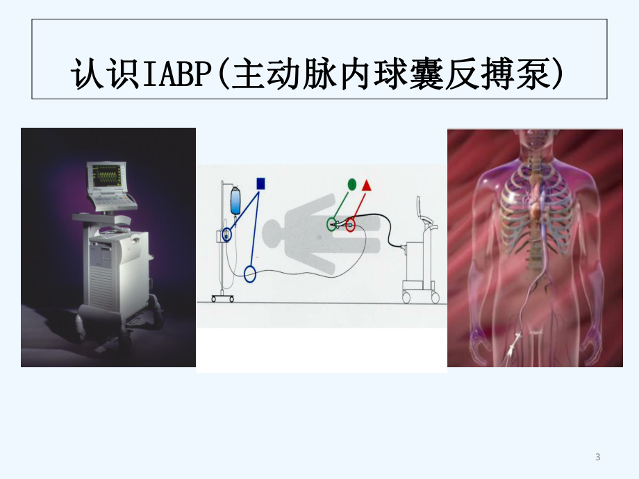 IABP主动脉球囊反搏-课件.ppt_第3页