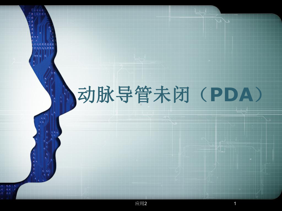 PDA(动脉导管未闭)(专业医学)课件.pptx_第1页