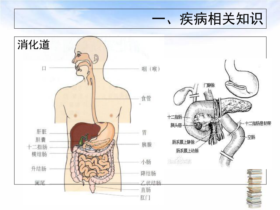 下消化道出血伴失血性休克护理查房课件.ppt_第3页