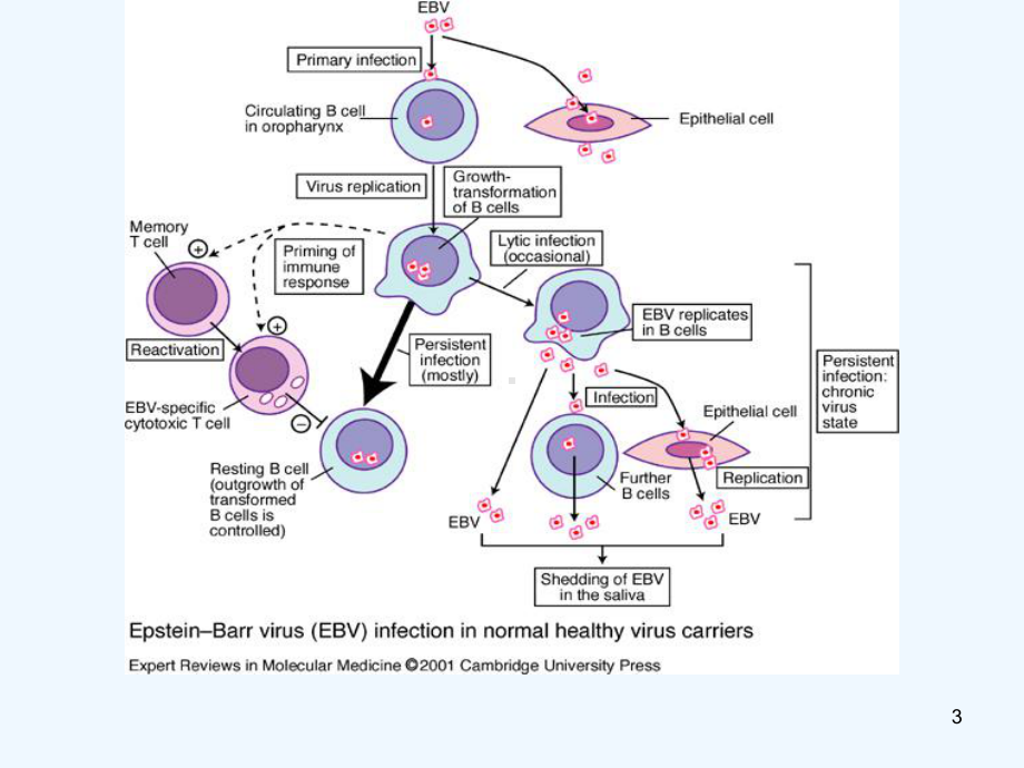 EB病毒感染相关疾病课件.ppt_第3页