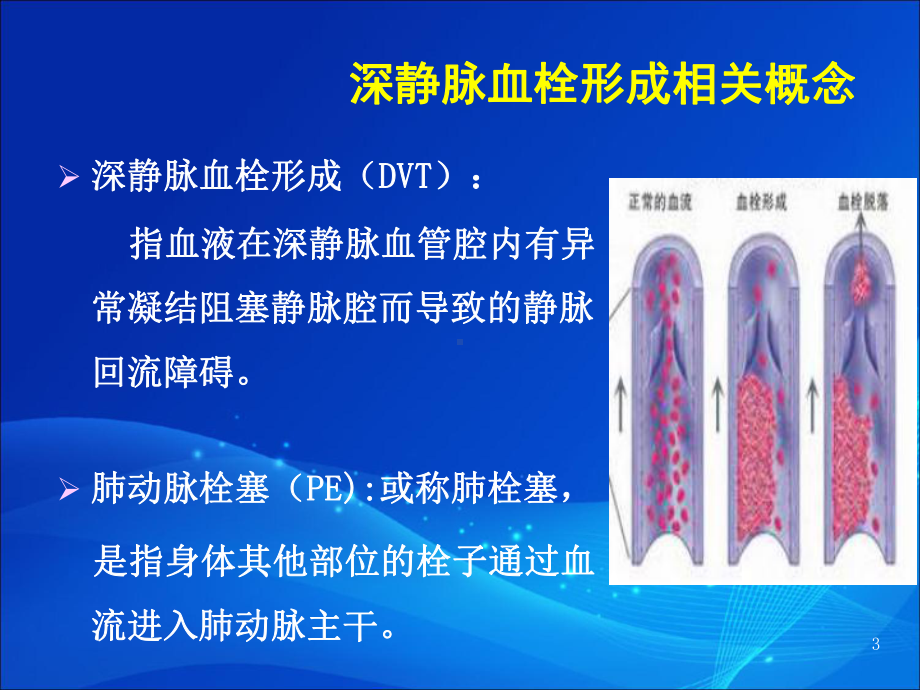 下肢深静脉血栓形成的防治指南课件-2.ppt_第3页