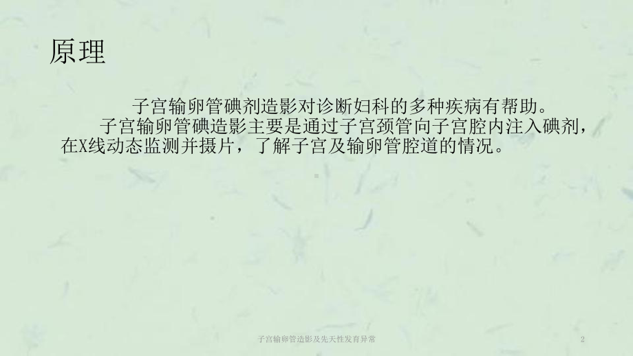 子宫输卵管造影及先天性发育异常课件.ppt_第2页