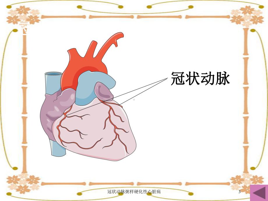 冠状动脉粥样硬化性心脏病培训课件.ppt_第3页