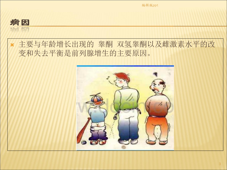 前列腺电切围手术期护理课件.ppt_第3页