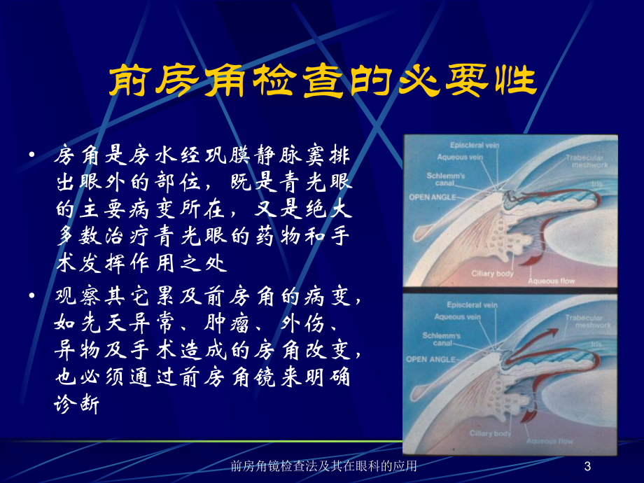 前房角镜检查法及其在眼科的应用课件.ppt_第3页