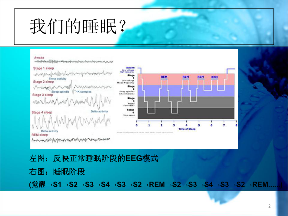 医学课件-护考辅导睡眠障碍教学课件.ppt_第2页