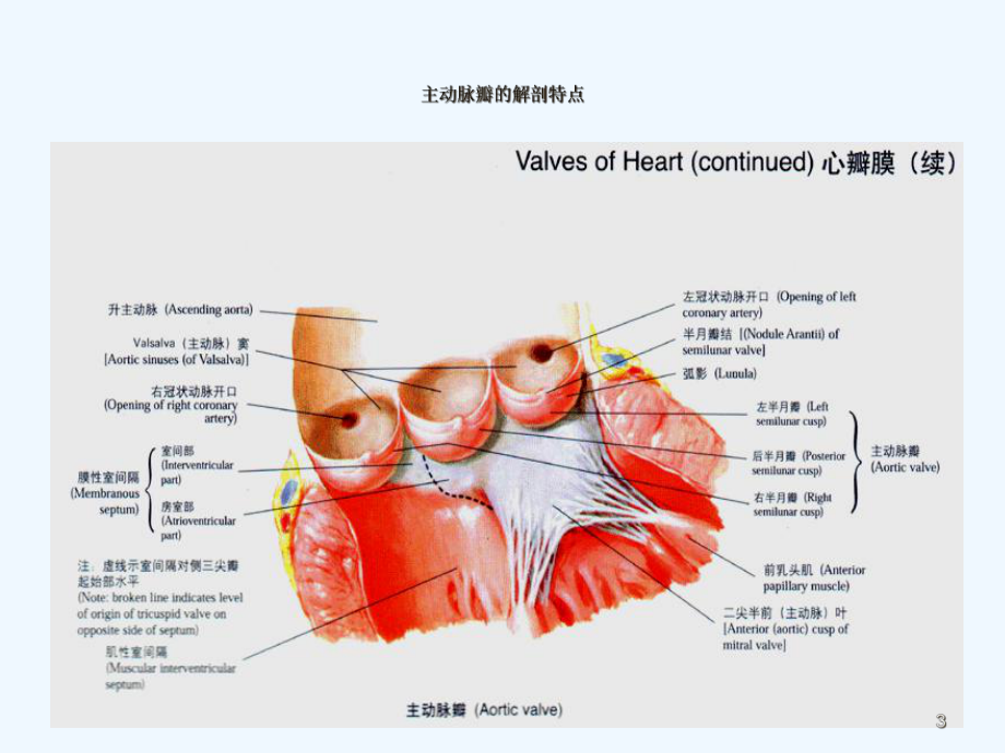 主动脉瓣疾病课件.ppt_第3页