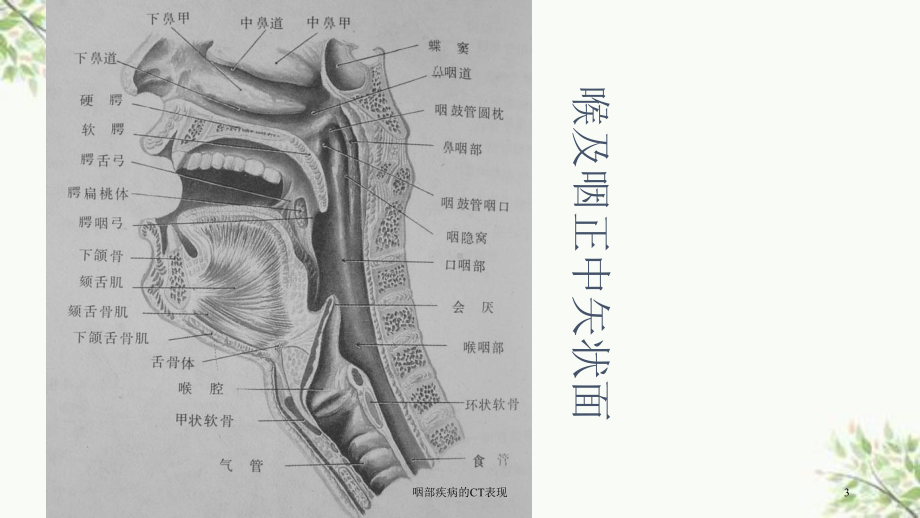 咽部疾病的CT表现课件.ppt_第3页