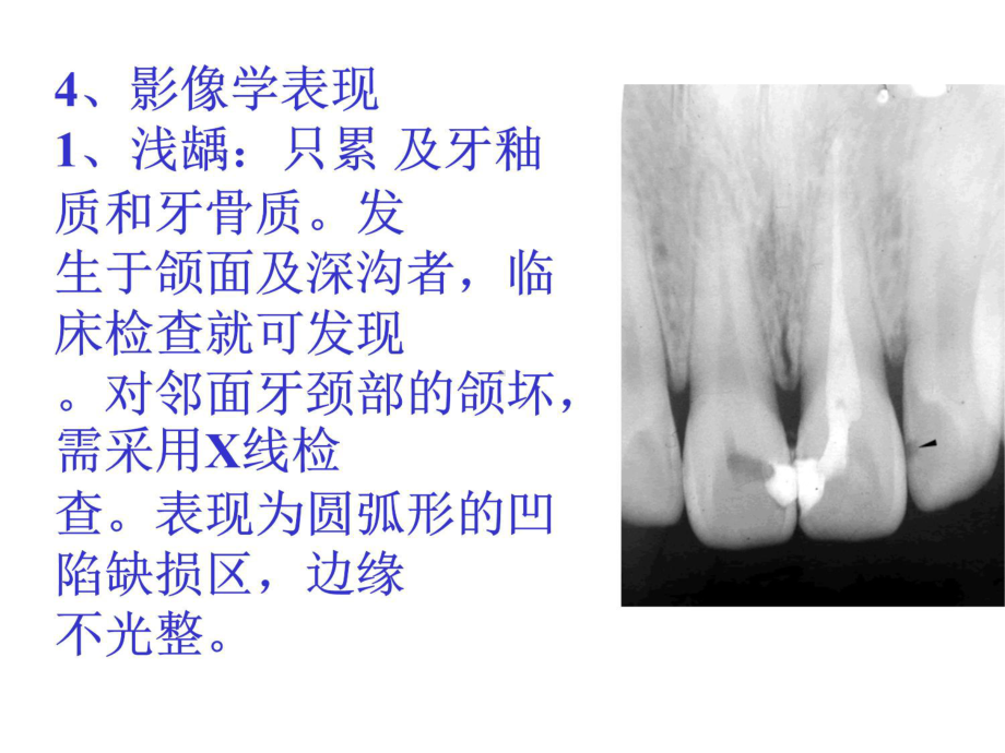 口腔颌面常见病诊断课件.ppt_第3页