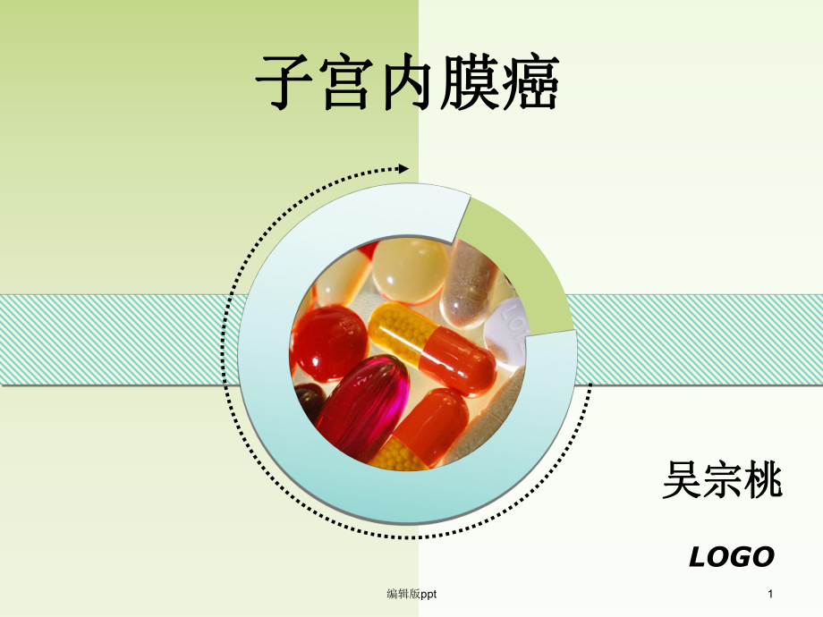 子宫内膜癌课件-2.ppt_第1页