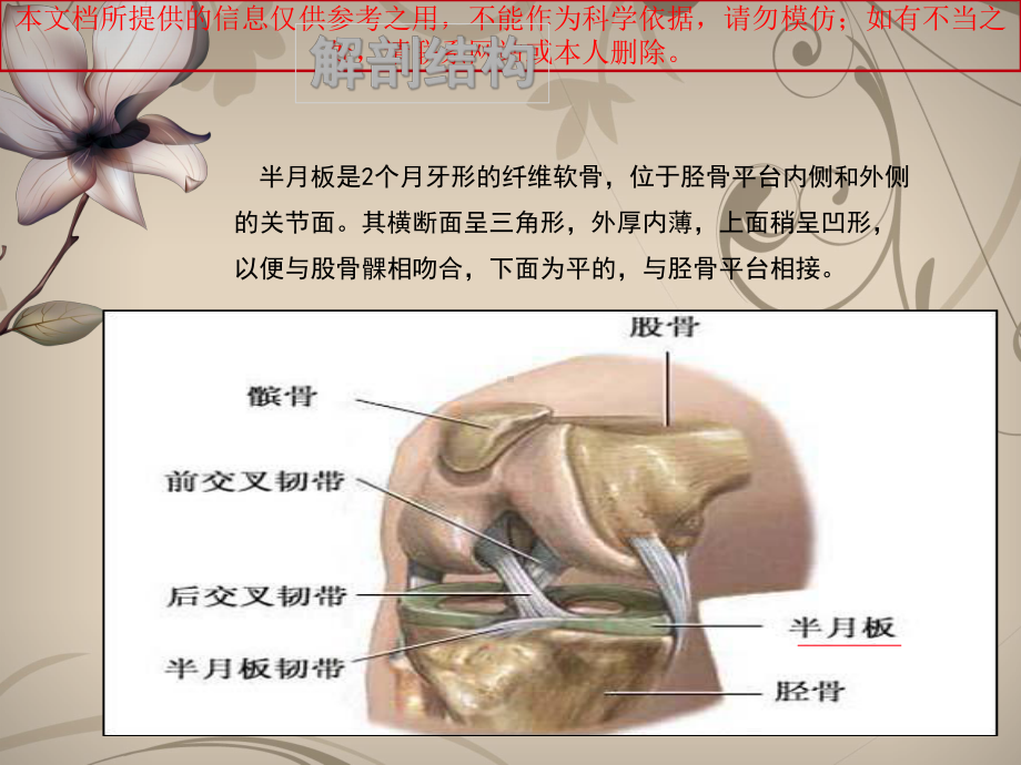 半月板损伤护理培训课件.ppt_第2页