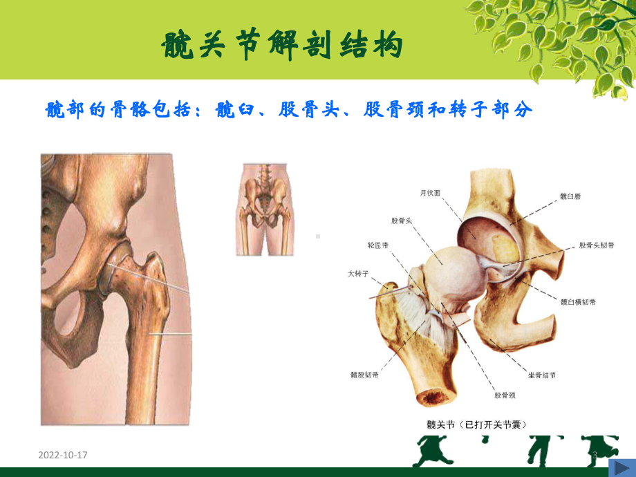 人工髋关节置换术康复护理参考课件.ppt_第3页