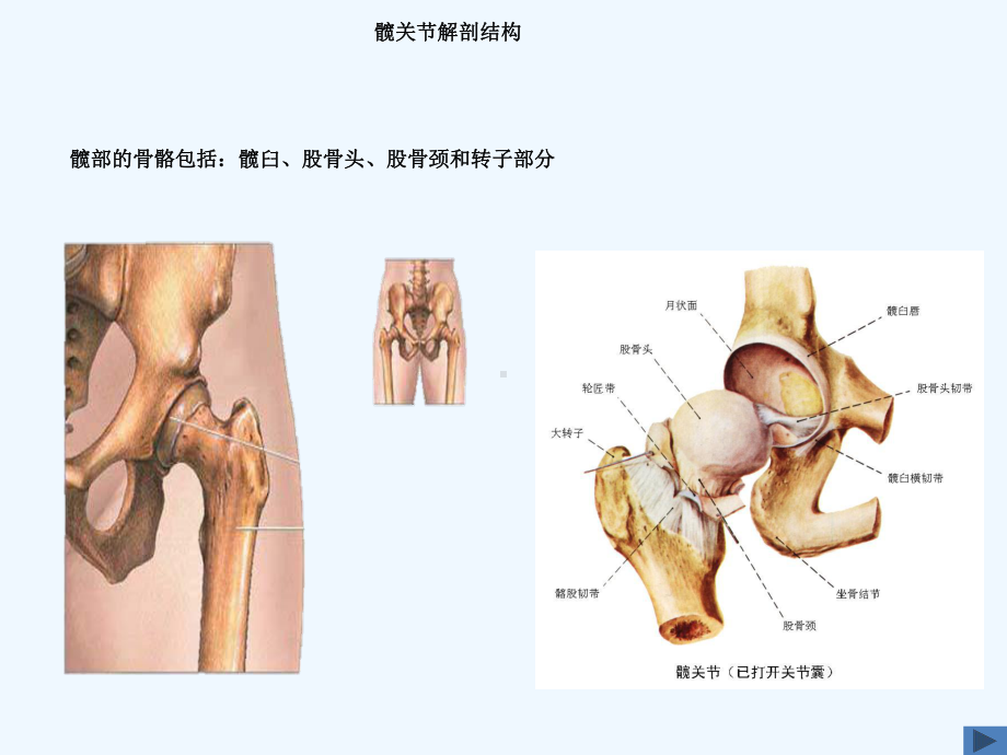 人工髋关节置换术康复护理课件.ppt_第3页