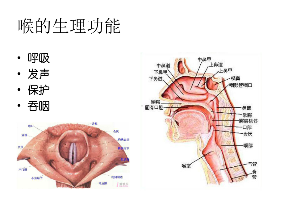 喉症状学喉梗阻气管切开术精选课件.ppt_第3页