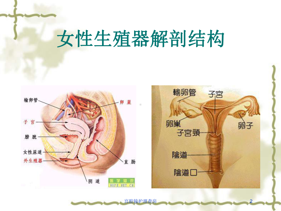 宫腔镜护理查房培训课件.ppt_第2页