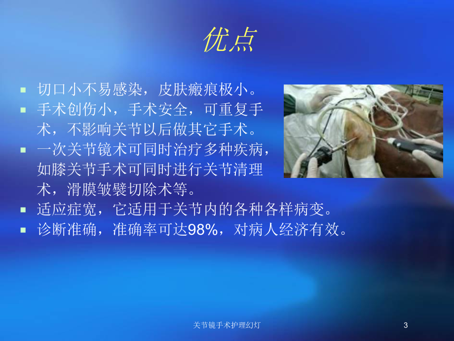 关节镜手术护理幻灯培训课件.ppt_第3页