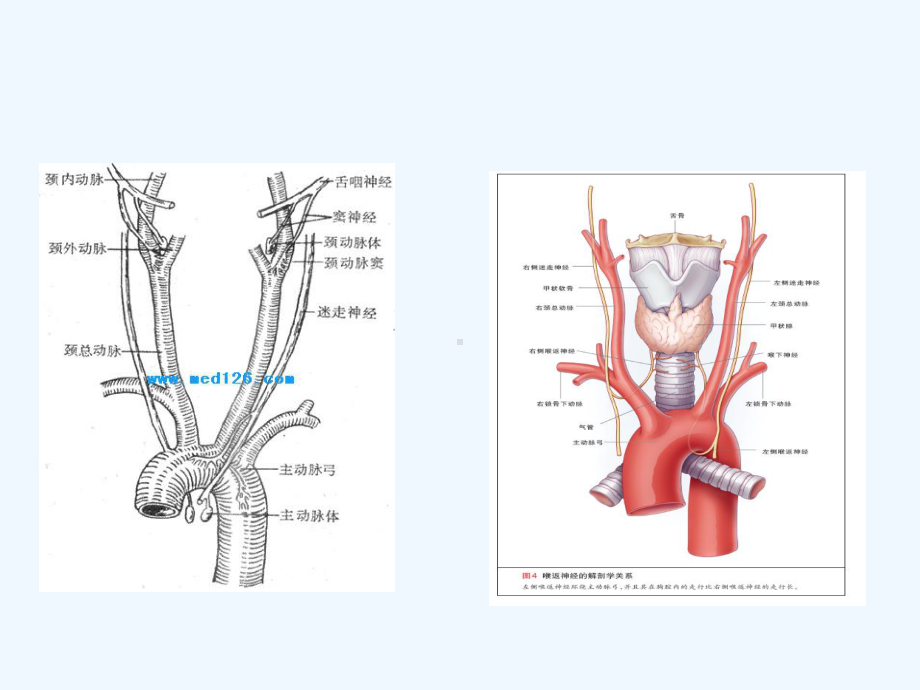 主动脉置换术解读课件.ppt_第3页