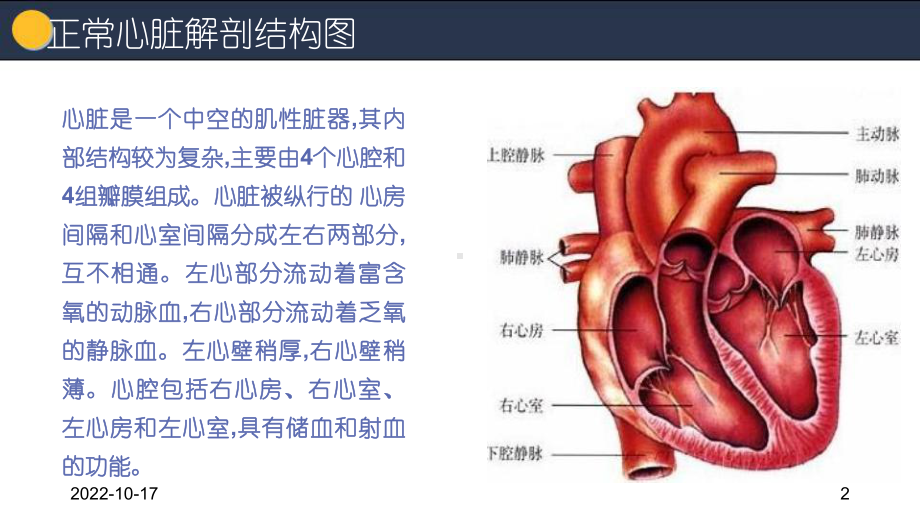 室间隔缺损护理查房参考课件.ppt_第2页