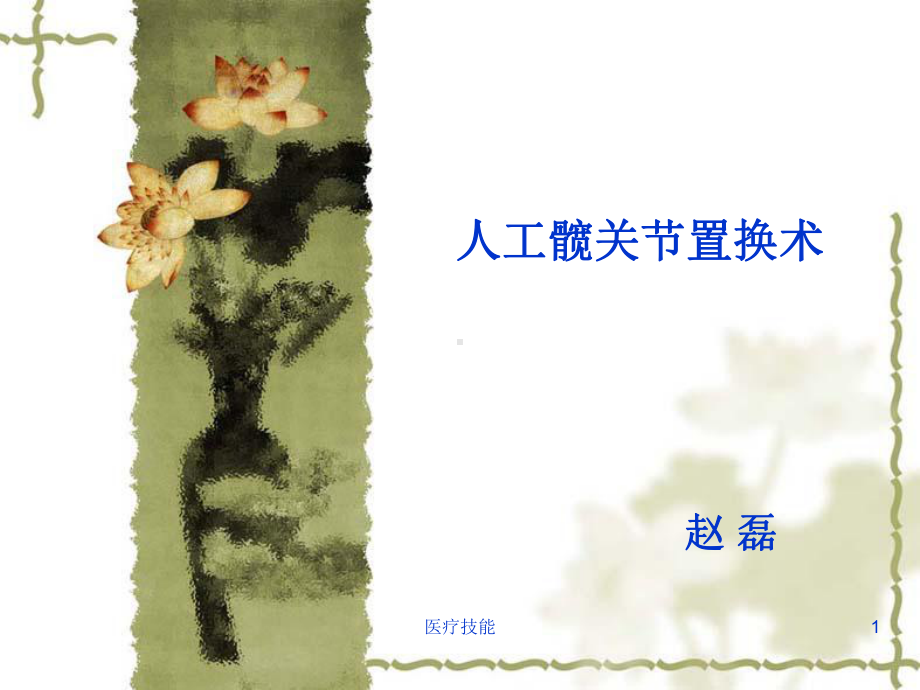 图解髋关节置换术(医学技术)课件.ppt_第1页