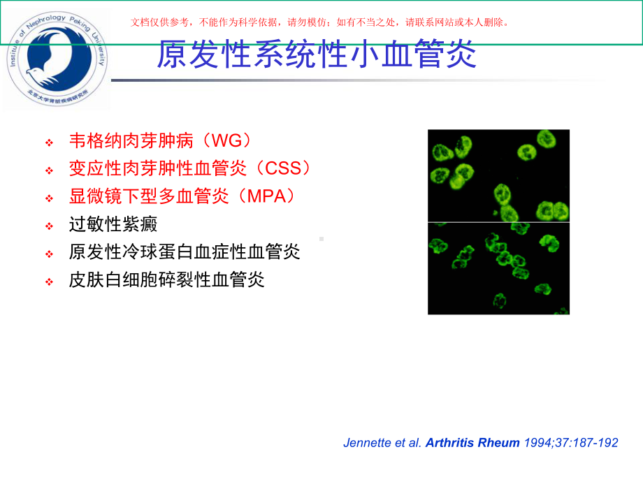 主治医查房ANCA相关小血管炎诊断和治疗进展培训课件.ppt_第2页