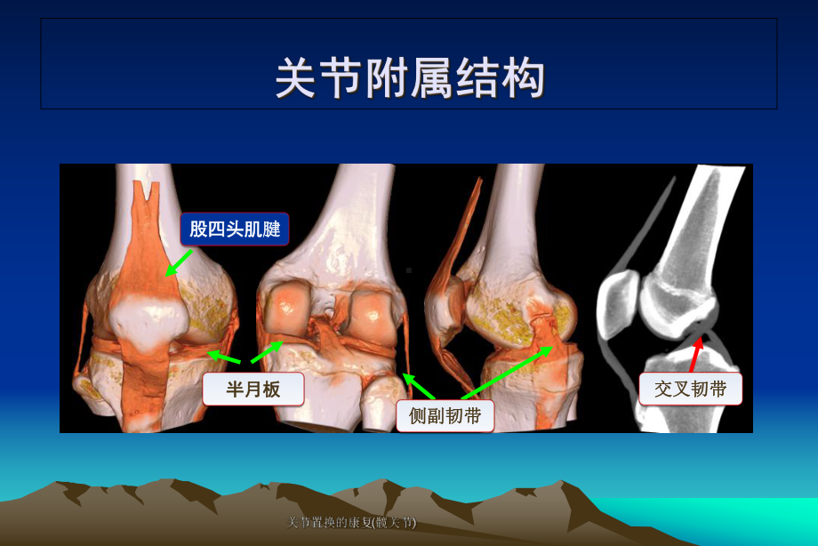 关节置换的康复(髋关节)课件.ppt_第3页