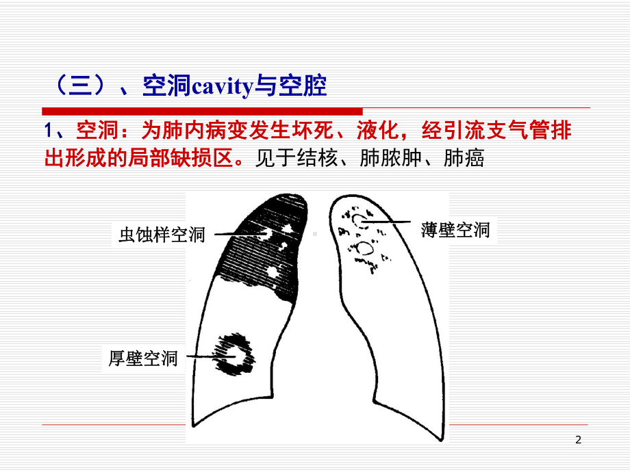 医学课件-呼吸基本病变课件.ppt_第2页